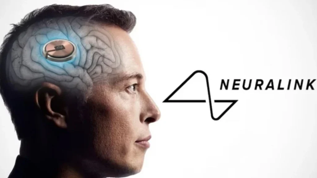 Neuralink